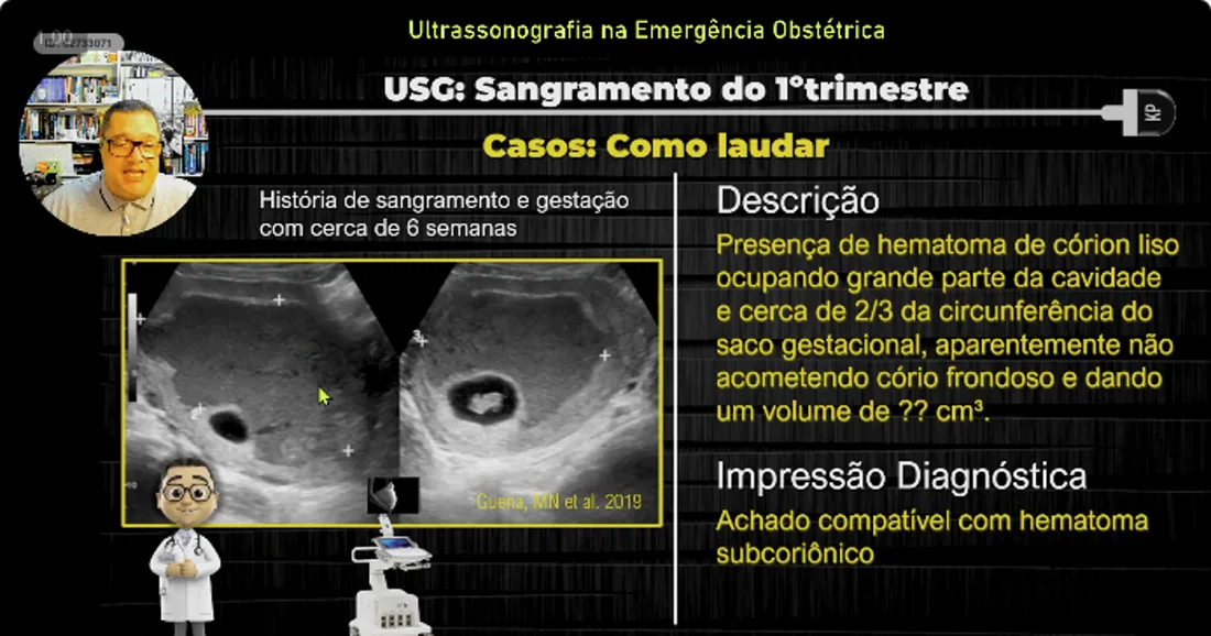 Slide da aula 02: Sangramento do 1º Trimestre
