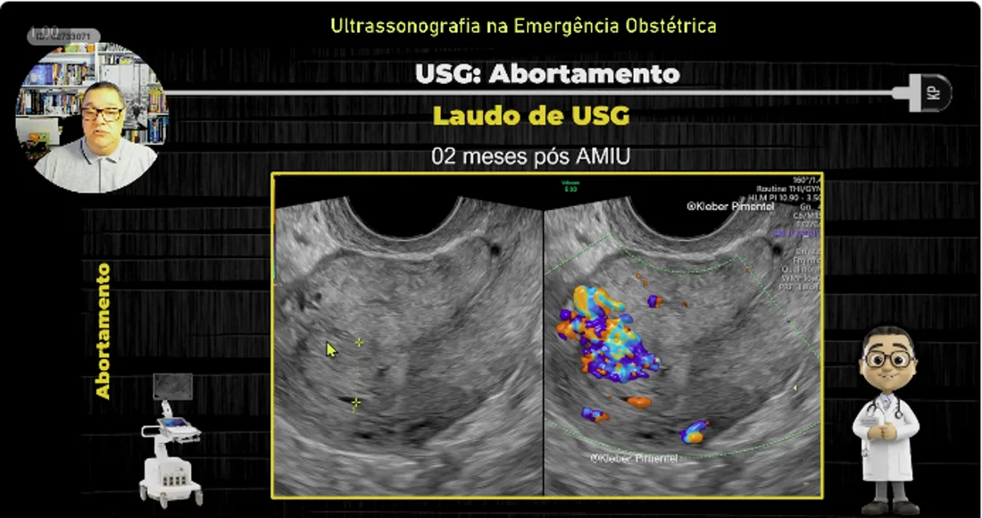 Slide da aula 05: Abortamento