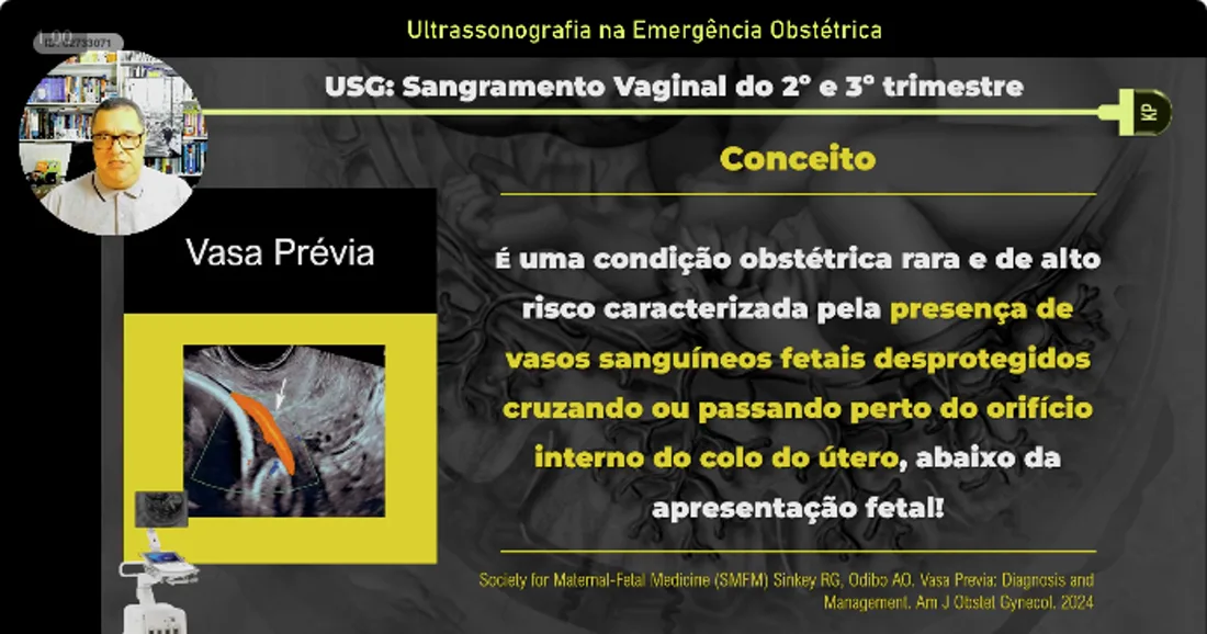 Slide da aula 06: Sangramento do 2º e 3º Trimestre