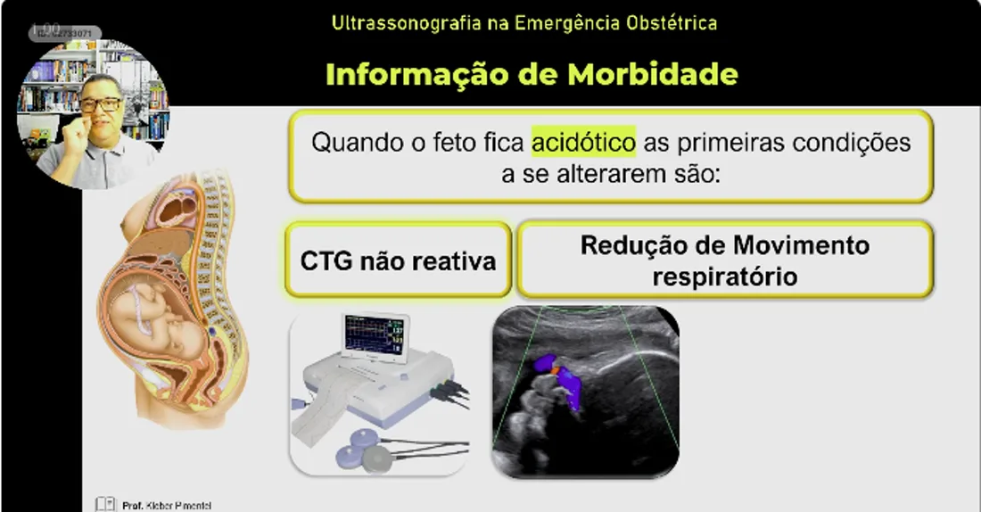 Slide da aula 08: Perfil Biofísico Fetal
