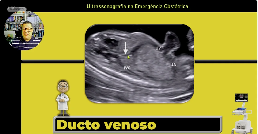 Slide da aula 09: Doppler na Emergência · Vasos e Técnica