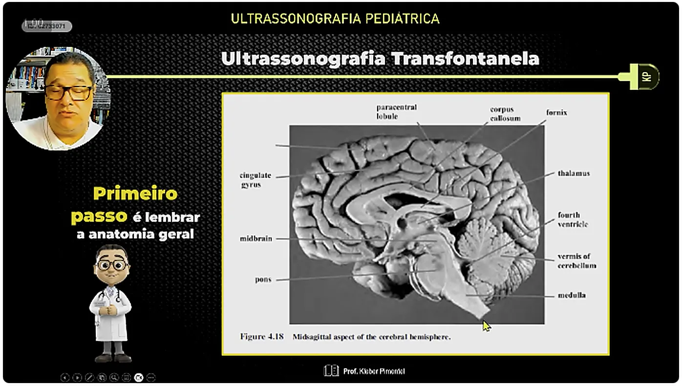 Slide da aula mostrando o corte sagital estrito com as estruturas da linha media identificadas